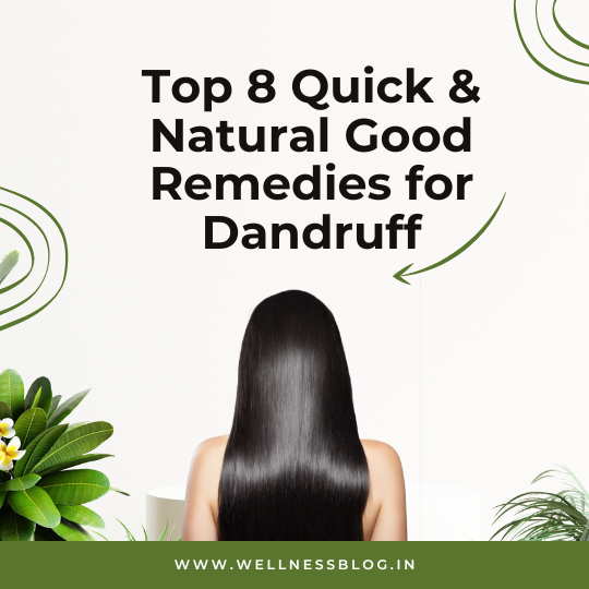 Top 8 Quick & Natural Good Remedies for Dandruff